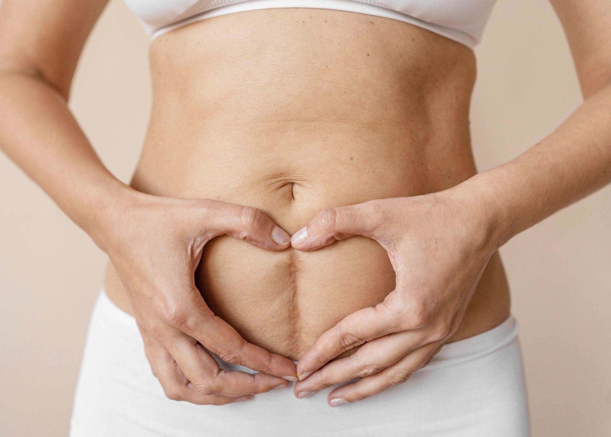 Cirurgia plástica depois da gravidez: O que você precisa saber antes de decidir