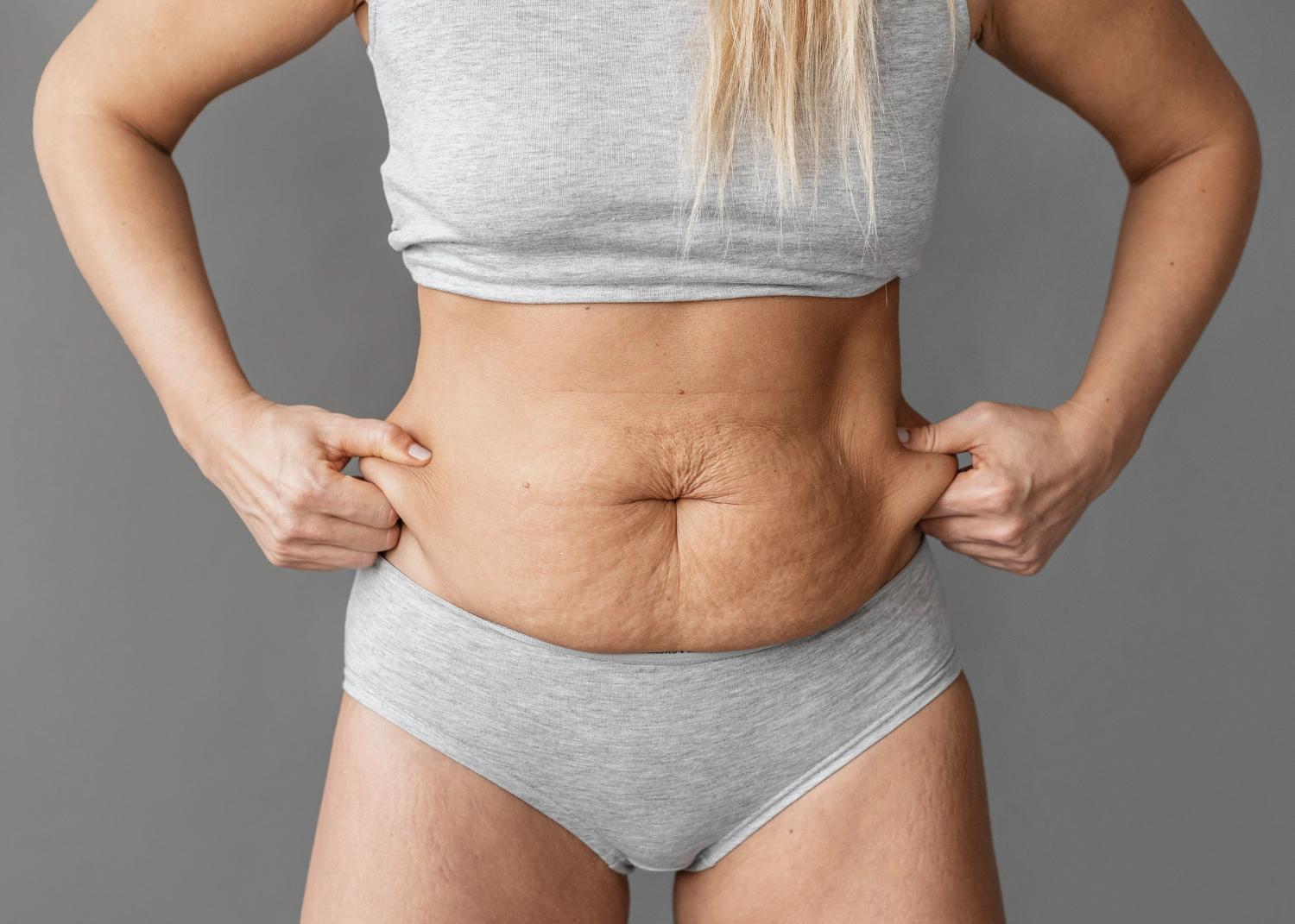 Tecnologia quantum na redução da flacidez: Um novo padrão em estética