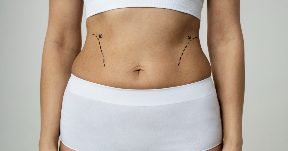 Como reduzir o inchaço após a cirurgia plástica com segurança